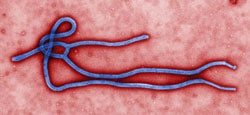 Elektronenmikroskopische Aufnahme Ebola-Virus Quelle: Cynthia Goldsmith, CDC